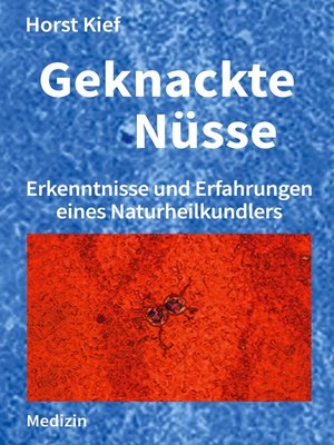 cover image of Geknackte Nüsse